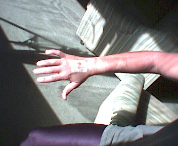 Picture of the arm
