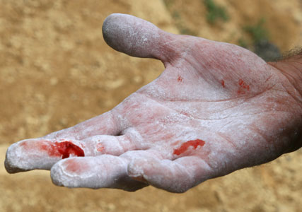 picture of mike's hand